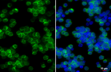 Anti-CD79a antibody [HL5600] used in Immunocytochemistry/ Immunofluorescence (ICC/IF). GTX646282
